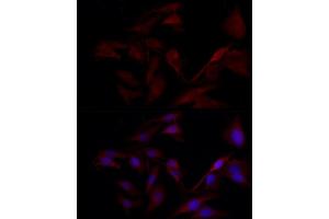 Immunofluorescence analysis of U2OS cells using TYK2 Rabbit pAb (ABIN3022987, ABIN3022988, ABIN3022989 and ABIN6219333) at dilution of 1:150 (40x lens). (TYK2 anticorps  (AA 750-850))