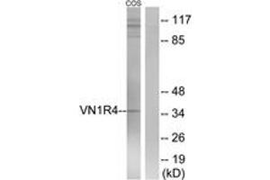 Western blot analysis of extracts from COS7 cells, using VN1R4 Antibody. (VN1R4 anticorps  (AA 88-137))
