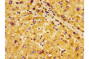 Immunohistochemistry of paraffin-embedded human liver tissue using ABIN7163666 at dilution of 1: 100 (PHLDA1 anticorps  (AA 1-138))