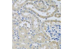 Immunohistochemistry of paraffin-embedded mouse kidney using CHMP1B antibody at dilution of 1:100 (x40 lens). (CHMP1B anticorps)
