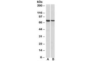Western blot testing of mouse [A] and rat [B] spleen lysates with MUNC18-3 antibody at 1ug/ml. (STXBP3 anticorps)