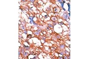 Image no. 2 for anti-V-Erb-A erythroblastic Leukemia Viral Oncogene Homolog 4 (Avian) (ERBB4) (pTyr1162) antibody (ABIN358139) (ERBB4 anticorps  (pTyr1162))