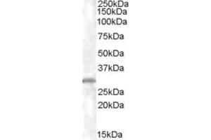 Western Blotting (WB) image for anti-Charged Multivesicular Body Protein 5 (CHMP5) (C-Term) antibody (ABIN2465529) (CHMP5 anticorps  (C-Term))