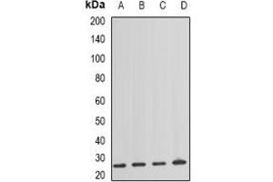 Western blot analysis of NAT8 expression in HEK293T (A), mouse spleen (B), mouse lung (C), rat kidney (D) whole cell lysates. (NAT8 anticorps)