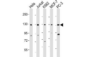 RFX1 anticorps  (C-Term)