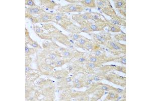 Immunohistochemistry of paraffin-embedded human liver using NUDT15 antibody at dilution of 1:100 (40x lens). (NUDT15 anticorps)
