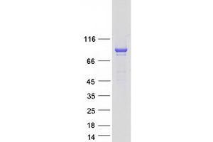 Validation with Western Blot