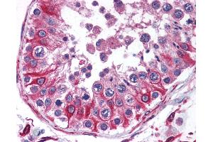 Anti-PTRH2 antibody IHC of human testis. (PTRH2 anticorps  (N-Term))