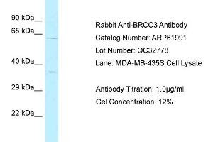 Western Blotting (WB) image for anti-BRCA1/BRCA2-Containing Complex, Subunit 3 (BRCC3) (C-Term) antibody (ABIN2788977) (BRCC3 anticorps  (C-Term))