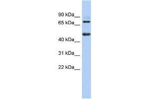 WB Suggested Anti-ZBTB26 Antibody Titration:  0. (ZBTB26 anticorps  (N-Term))