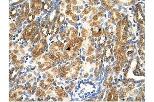 MAS1 antibody was used for immunohistochemistry at a concentration of 4-8 ug/ml to stain Epithelial cells of renal tubule (arrows) in Human Kidney.