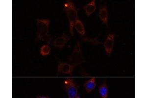 Immunofluorescence analysis of NIH/3T3 cells using YTHDC2 Polyclonal Antibody at dilution of 1:100. (YTHDC2 anticorps)