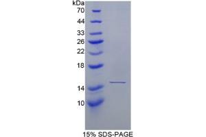 SDS-PAGE of Protein Standard from the Kit (Highly purified E. (Haptoglobin Kit ELISA)