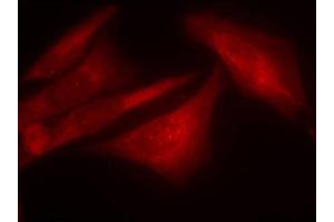 Immunofluorescence staining of methanol-fixed Hela cells using Phospho-G3BP1-S232 antibody.