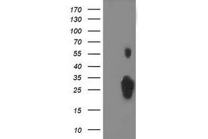 Western Blotting (WB) image for anti-Chromosome 1 Open Reading Frame 50 (C1ORF50) antibody (ABIN1497034) (C1ORF50 anticorps)