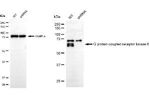 Western blotting analysis using G protein-coupled receptor kinase 6 antibody (ABIN7798675).