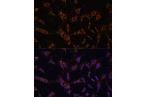 Immunofluorescence analysis of C6 cells using UBE2J1 antibody (ABIN7271172) at dilution of 1:100.