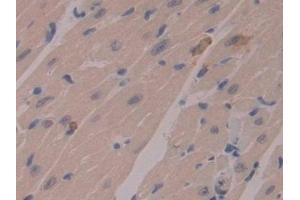 Detection of MMP7 in Mouse Heart Tissue using Polyclonal Antibody to Matrix Metalloproteinase 7 (MMP7)