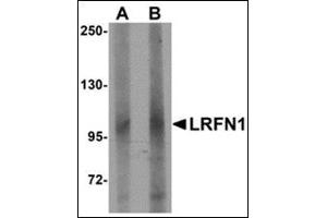 Western blot analysis of LRFN1 in human brain lysate with this product at (A) 1 and (B) 2 μg/ml. (LRFN1 anticorps  (C-Term))