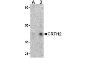 Western blot analysis of CRTH2 in human heart tissue lysate with CRTH2 antibody at (A) 1 and (B) 2 μg/ml. (Prostaglandin D2 Receptor 2 (PTGDR2) (Center) anticorps)