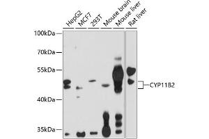 Western blot analysis of extracts of various cell lines, using CYP11B2 antibody (ABIN1679468, ABIN3015492, ABIN3015493 and ABIN6218533) at 1:1000 dilution. (CYP11B2 anticorps  (AA 234-503))