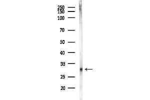 anti-Glutamate-Cysteine Ligase, Modifier Subunit (GCLM) (N-Term) antibody