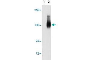 Western blot analysis of JAG2 (arrow) using JAG2 polyclonal antibody . (JAG2 anticorps  (C-Term))