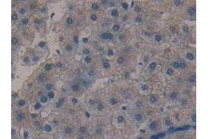 Detection of MBL in Human Liver Tissue using Polyclonal Antibody to Mannose Binding Lectin (MBL) (MBL2 anticorps  (AA 130-248))