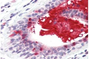 Anti-APRIL antibody IHC staining of human breast. (TNFSF13 anticorps  (Internal Region))