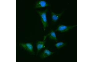 IF analysis of Alpha Actinin 4 using anti-Alpha Actinin 4 antibody (ABIN4886421). (alpha Actinin 4 anticorps  (AA 561-661))