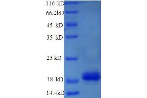 SDS-PAGE (SDS) image for Lysine (K)-Specific Demethylase 5A (KDM5A) (AA 437-603) protein (His tag) (ABIN5713580)