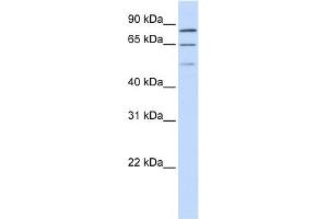 WB Suggested Anti-ZNF699 Antibody Titration:  0. (ZNF699 anticorps  (N-Term))