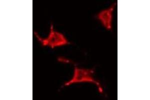 ABIN6266801 staining 293 by IF/ICC. (YTHDF1 anticorps  (N-Term))