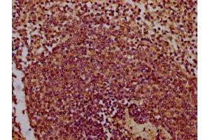 IHC image of ABIN7147649 diluted at 1:300 and staining in paraffin-embedded human spleen tissue performed on a Leica BondTM system.