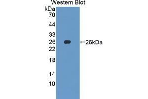 Detection of Recombinant SKP1, Human using Polyclonal Antibody to S-Phase Kinase Associated Protein 1 (SKP1) (SKP1 anticorps  (AA 1-163))