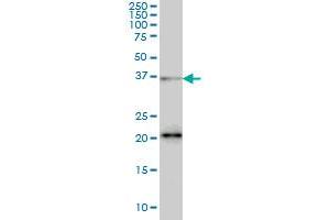 FUSIP1 monoclonal antibody (M03), clone 1A6 Western Blot analysis of FUSIP1 expression in Hela S3 NE . (SRSF10 anticorps  (AA 1-100))