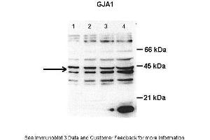 Lanes:   Lane1: 8 ug total cardiac lysate Lane2: 15 ug total cardiac lysate Lane3: 30 ug total cardiac lysate  Lane4: 50 ug total cardiac lysate  Primary Antibody Dilution:   0.
