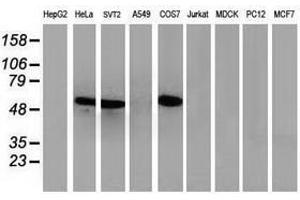 Image no. 5 for anti-Tumor Protein P53 (TP53) antibody (ABIN1499973) (p53 anticorps)