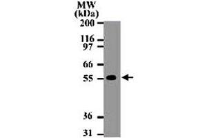 Western blot analysis of 15 ug of total cell lysate from Daudi cells with TNFRSF10A monoclonal antibody, clone 32A1380  at 2 ug/mL . (TNFRSF10A anticorps  (AA 1-20))