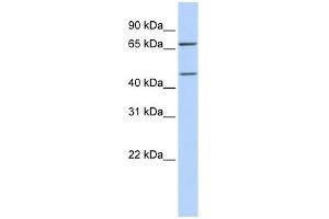 SLC5A7 antibody used at 1 ug/ml to detect target protein. (ChT anticorps)