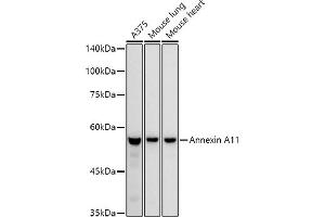 Western blot analysis of extracts of various cell lines, using Annexin  antibody (ABIN7265618) at 1:1000 dilution. (Annexin A11 anticorps)