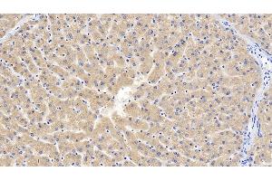 Detection of GFRa1 in Human Liver Tissue using Polyclonal Antibody to Glial Cell Line Derived Neurotrophic Factor Receptor Alpha 1 (GFRa1)