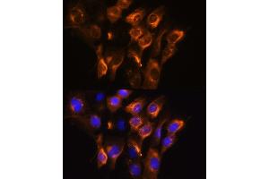 Immunofluorescence analysis of C6 cells using  Rabbit pAb (ABIN6134011, ABIN6136599, ABIN6136600 and ABIN6224718) at dilution of 1:100. (ADRB3 anticorps  (AA 1-100))