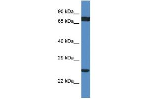 WB Suggested Anti-RPL7A AntibodyTitration: 1. (RPL7A anticorps  (C-Term))