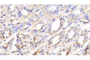 Detection of GCK in Mouse Stomach Tissue using Polyclonal Antibody to Glucokinase (GCK) (GCK anticorps  (AA 3-226))