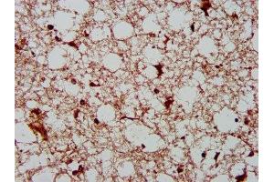 IHC image of ABIN7165027 diluted at 1:400 and staining in paraffin-embedded human brain tissue performed on a Leica BondTM system. (AHNAK2 anticorps  (AA 195-349))