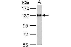WB Image Amphiphysin antibody [N1N2], N-term detects AMPH protein by Western blot analysis. (Amphiphysin anticorps  (N-Term))