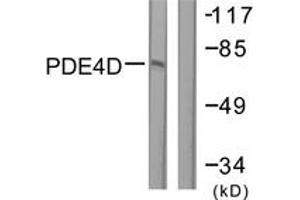 Western blot analysis of extracts from K562 cells, treated with H2O2 100uM 30', using PDE4D (Ab-190/53) Antibody. (PDE4D anticorps  (AA 156-205))