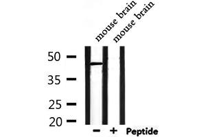 Western blot analysis of extracts from mouse brain, using NPY1R Antibody. (NPY1R anticorps  (Internal Region))