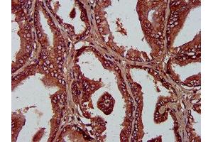 IHC image of ABIN7163316 diluted at 1:400 and staining in paraffin-embedded human prostate tissue performed on a Leica BondTM system.